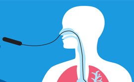 Bronchoscopy Specialist in Delhi