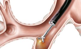 Best Pulmonologist doctor in Delhi