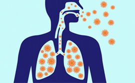 Pneumonia specialist in Delhi